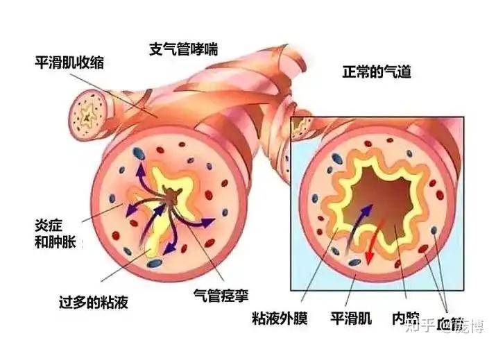过敏可以有多严重？  第4张