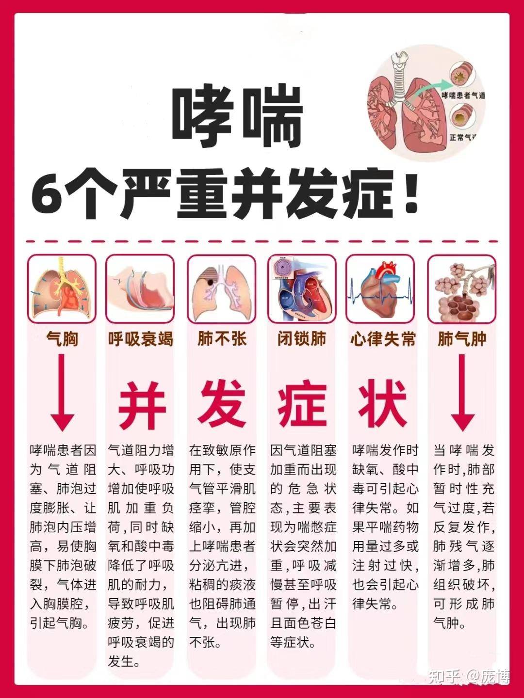 过敏可以有多严重？  第3张