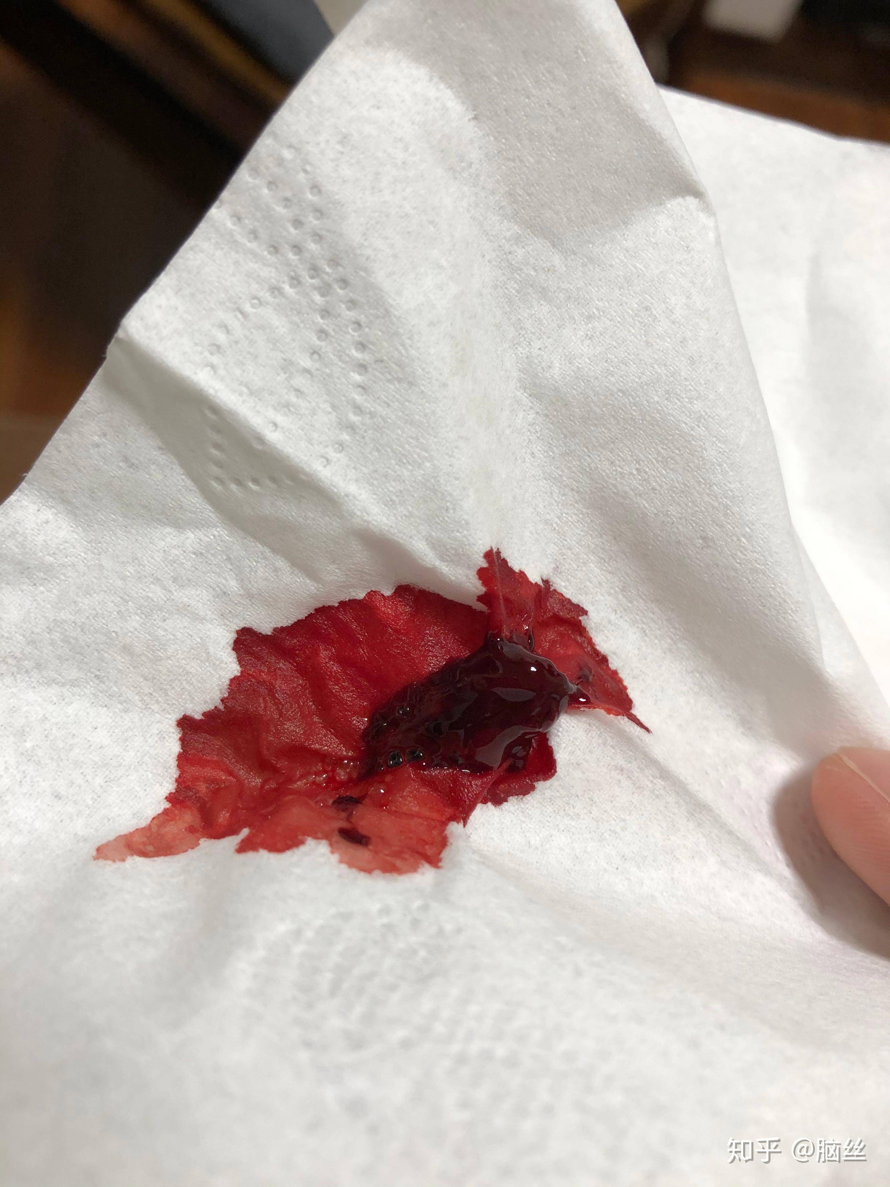 一个人可以孤独到什么样子？  第1张
