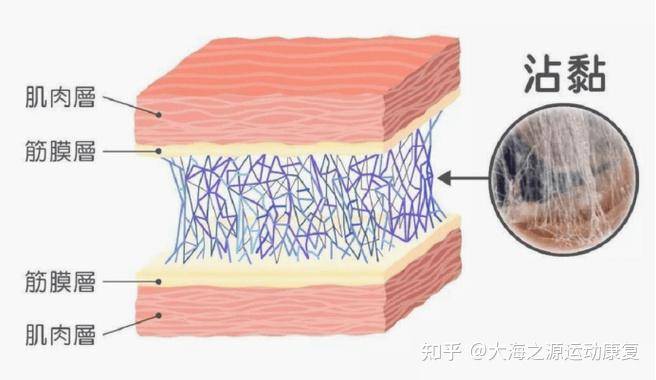 有没有腰肌劳损的哥哥姐姐们可以分享一下怎么缓解疼痛吗？  第8张