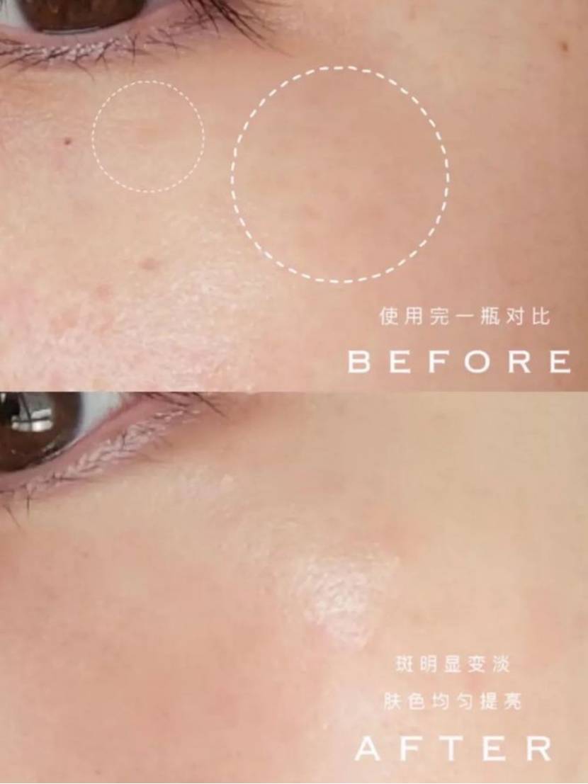有哪些相见恨晚的美白精华？  第12张
