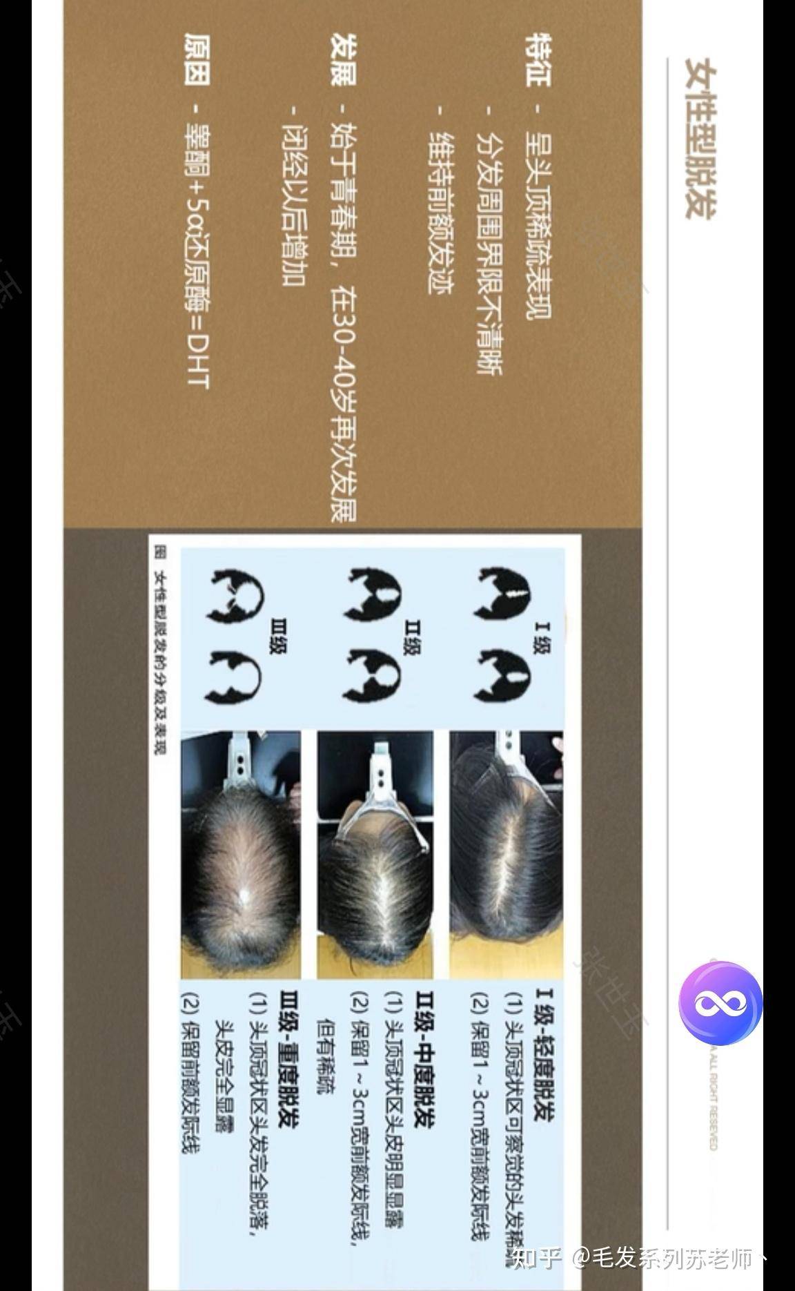 容易掉头发怎么办？  第1张